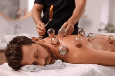 Cupping Therapy
